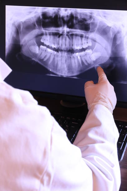 Best Dentist for Tooth Abscess  in Osseo, MN