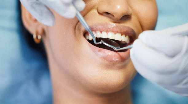 Best Emergency Tooth Extraction  in Osseo, MN