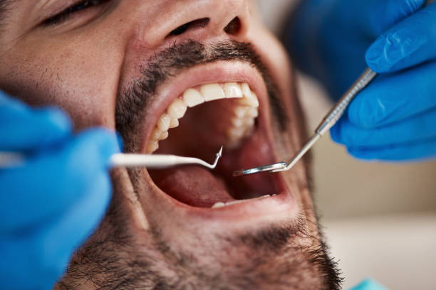 Best Teeth Whitening  in Osseo, MN